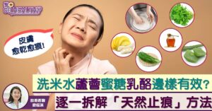 洗米水蘆薈蜜糖乳酪邊樣有效？　逐一拆解「天然止痕」方法